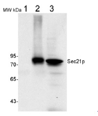 Sec21p | Gamma subunit, COP vesicles in the group Antibodies Plant/Algal / Membrane Transport System / Endomembrane system at Agrisera AB (Antibodies for research) (AS08 327)